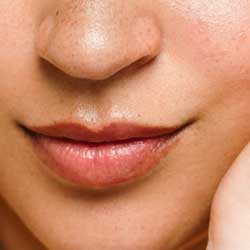 Lip Volume Consultation