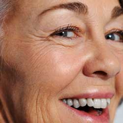 Skin Needling Consultation